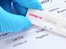 COVID-19: Município registra mais 12 pessoas com o vírus na cidade