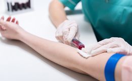 Sobe para 439 o número de pessoas recuperadas da COVID em SMO