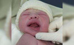 Bebê nasce com dois dentes e surpreende família em Francisco Beltrão