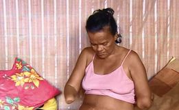 Mulher sem mãos e pernas tem pedido de benefício negado por não poder assinar papel