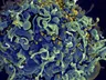 HIV: médicos anunciam 4º caso de cura no mundo