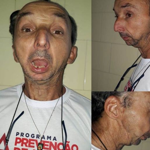 Caminhoneiro de São José do Cedro busca ajuda para realização de cirurgia