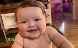 Pais criam campanha para custear cirurgia da filha