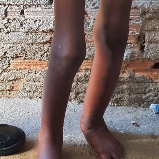 Vídeo mostra resgate de criança presa dentro de barril de ferro