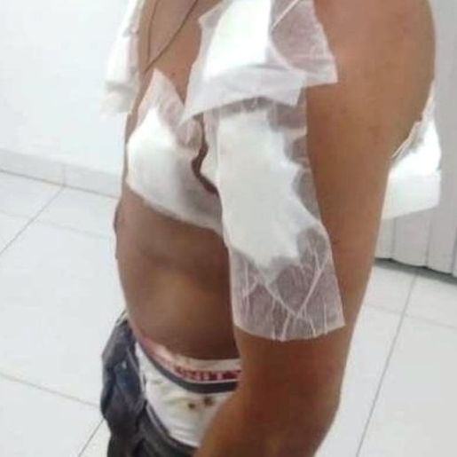 Homem sofre tentativa de homicídio em São Lourenço do Oeste
