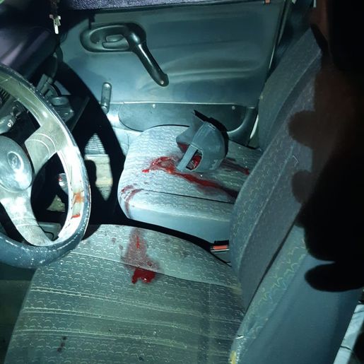 Vítima de disparo de arma de fogo morre no hospital 