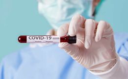 COVID: Mais 11 pessoas testam positivo e número chega a 43 em SMO