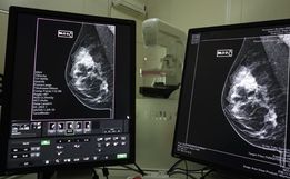 SC realiza mutirão de mamografias com prioridade para pacientes na fila de espera