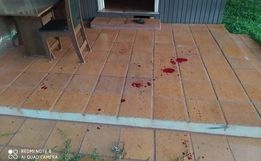 Homem é esfaqueado por estar "flertando" com mulher casada