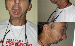 Caminhoneiro de São José do Cedro busca ajuda para realização de cirurgia
