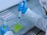 VÍDEO: Startup de SC vai produzir tecido pulmonar para testes de COVID-19