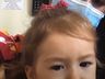 VÍDEO: Sofia Helena recebe nesta quinta-feira a dose do Zolgensma