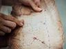 Homem usa mapa deixado pelo pai para encontrar tesouro milionário enterrado pela família há 80 anos