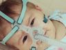 OUÇA: Mãe da Sofia Helena relata drama vivido com filha diagnosticada com AME 