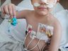 Recuperação do pequeno Leo surpreende médicos após transplante de medula