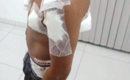 Homem sofre tentativa de homicídio em São Lourenço do Oeste