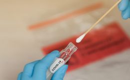 Sobe para 51 o número de pessoas com a COVID-19 em SMO