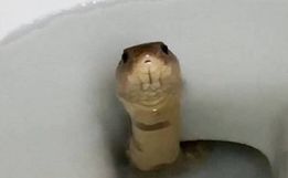 Turista passa por cirurgia no pênis após ser picado por cobra em vaso sanitário