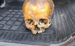 Crânio humano usado como "decoração" é encontrado no lixo 
