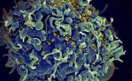 HIV: médicos anunciam 4º caso de cura no mundo