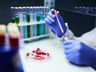 COVID-19: Mais oito pessoas entram para a lista de recuperados em SMO