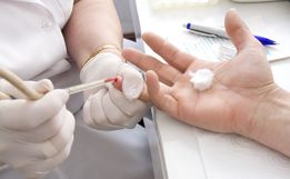 Departamento de IST/Aids e hepatites virais realiza testagem na população