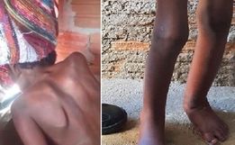 Menino acorrentado em tambor segue internado e deverá ir a abrigo