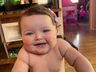 Pais criam campanha para custear cirurgia da filha