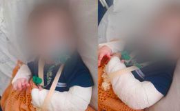 Hospital Regional apura caso de bebê que teve braço quebrado durante internação