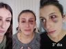 VÍDEO: maquiadora usa redes sociais para denunciar agressões do namorado em SMO