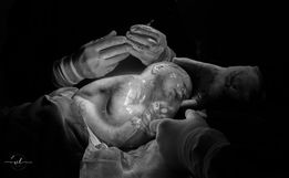 Parto raro realizado por obstetra em São Miguel do Oeste chama atenção nas redes sociais