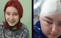 Família de São Lourenço do Oeste pede ajuda para tratamento da filha com câncer