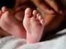 Bebê nasce com três pênis; caso é único na medicina