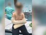 Criança cai de Balanço em escola e sofre fraturas nos braços em Paraíso, mãe acusa negligência