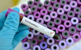 Sobe para 7 o número de casos de Coronavírus em São Miguel do Oeste