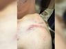 Polícia Civil identifica agressor envolvido em briga na Oktoberfest em menos de 24 horas