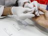 Unoesc inicia exames gratuitos para diagnóstico de Hepatite C