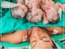 Confira como estão os trigêmeos que perderam a mãe em Itajaí