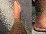 Neymar compartilha foto de tornozelo inchado após lesão