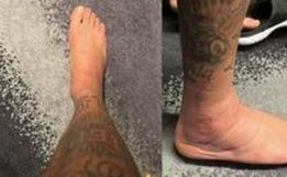 Neymar compartilha foto de tornozelo inchado após lesão