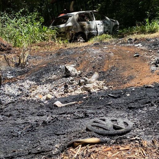 Suspeito de atear fogo em carro com a esposa dentro passa por cirurgia