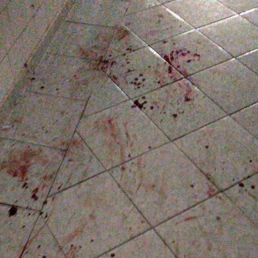Homens invadem hospital para agredir paciente durante a madrugada 
