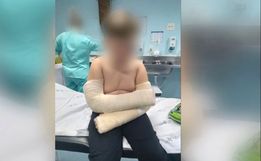 Criança cai de Balanço em escola e sofre fraturas nos braços em Paraíso, mãe acusa negligência