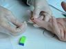 Saúde oportuniza testagem rápida de Hepatite para a população