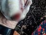 ONGs recolhem cães que tiveram caudas cortadas em São Miguel do Oeste