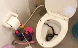 Jovem é picado no pênis por cobra de um metro enquanto usava o banheiro