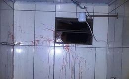 Ladrão morre após se machucar em janela de banheiro ao arrombar casa em Chapecó