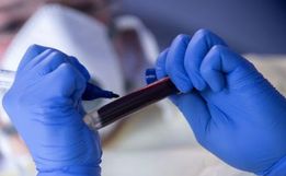 São Miguel do Oeste registra recorde de recuperados com 52 pessoas