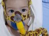 Bebê Valentim que luta contra a AME é sorteado para receber medicamento mais caro do mundo