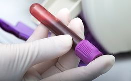 Com 72 confirmações e 45 recuperados, SMO tem 27 pessoas com coronavírus